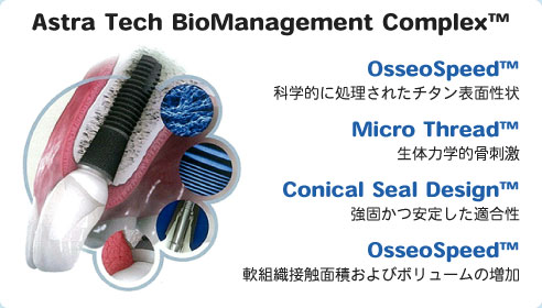 Astra Tech BioManagement Complex™の概要